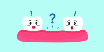 Options for Tooth Replacement