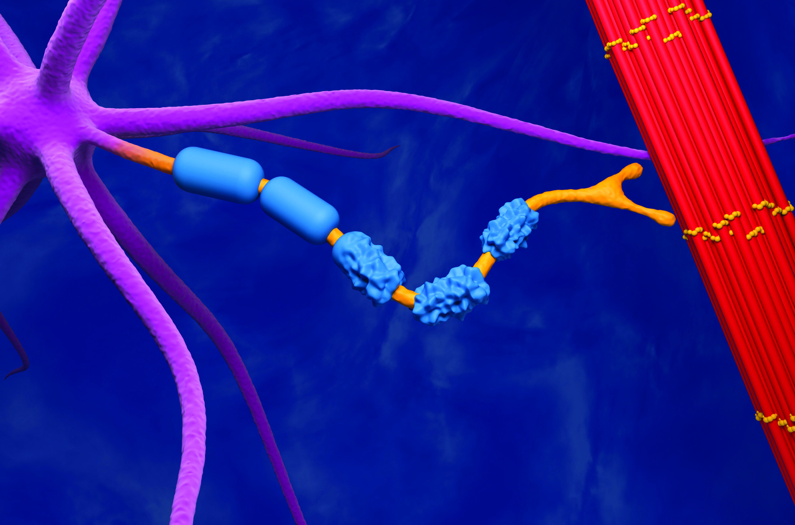 A visual representation of ALS as a degenerative neuromuscular disease.